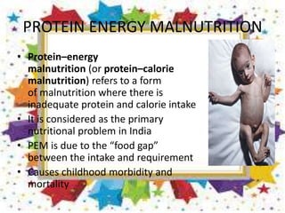 PROTEIN ENERGY MALNUTRITION
• Protein–energy
malnutrition (or protein–calorie
malnutrition) refers to a form
of malnutrition where there is
inadequate protein and calorie intake
• It is considered as the primary
nutritional problem in India
• PEM is due to the “food gap”
between the intake and requirement
• Causes childhood morbidity and
mortality
 