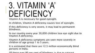 3. VITAMIN ‘A’
DEFICIENCYVitamin A is necessary for good eyesight.
In children, Vitamin A deficiency causes loss of eyesight.
If this deficiency is very severe, it may lead to permanent
blindness.
In our country every year 30,000 children lose eye sight due to
Vitamin A deficiency.
Vitamin A deficiency symptoms are seen more severely in
children of age group 1 to 5 years.
It is estimated that there are 12.5 million economically blind
persons in India.
 