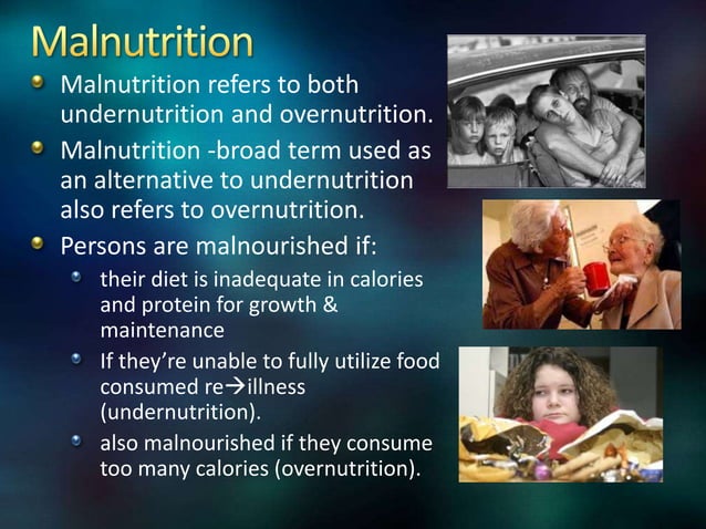 Nutritional status types