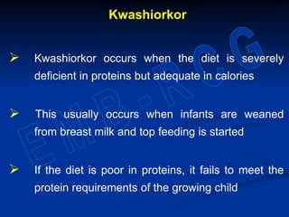 Kwashiorkor
 Kwashiorkor occurs when the diet is severely
deficient in proteins but adequate in calories
 This usually occurs when infants are weaned
from breast milk and top feeding is started
 If the diet is poor in proteins, it fails to meet the
protein requirements of the growing child
 