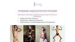 Белковая и белково-энергетическая недостаточность
ПРИЧИНЫ:
• Недостаточное питание
• Анорексия, нервная анорексия
• Заболевания, сопровождающиеся истощением
ПРОБЛЕМЫ НЕДОСТАТОЧНОГО ПИТАНИЯ
 