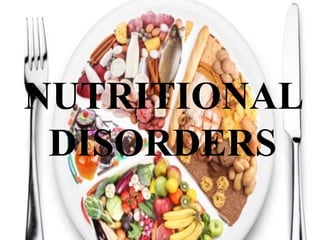 NUTRITIONAL
DISORDERS
 