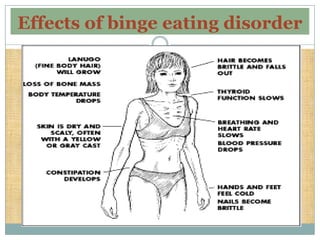 Effects of binge eating disorder
 