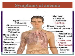 Symptoms of anemia
 