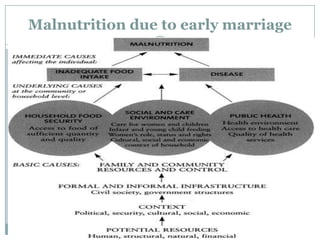 Malnutrition due to early marriage
 