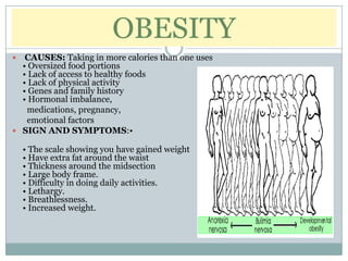 OBESITY
  CAUSES: Taking in more calories than one uses
  • Oversized food portions
  • Lack of access to healthy foods
  • Lack of physical activity
  • Genes and family history
  • Hormonal imbalance,
   medications, pregnancy,
   emotional factors
 SIGN AND SYMPTOMS:•

    • The scale showing you have gained weight
    • Have extra fat around the waist
    • Thickness around the midsection
    • Large body frame.
    • Difficulty in doing daily activities.
    • Lethargy.
    • Breathlessness.
    • Increased weight.
 