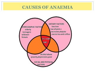 CAUSES OF ANAEMIA
 