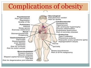 Complications of obesity
 