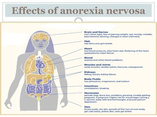 Effects of anorexia nervosa
 