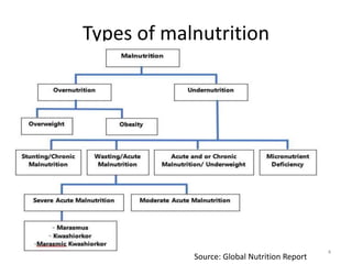 Types of malnutrition
Source: Global Nutrition Report
4
 