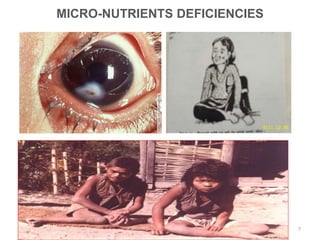 MICRO-NUTRIENTS DEFICIENCIES
7
 