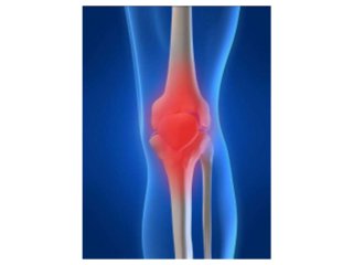 Nutrition for joint health