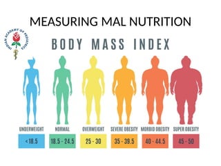 MEASURING MAL NUTRITION
 