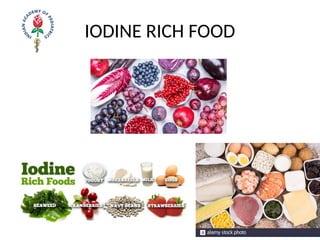 IODINE RICH FOOD
 