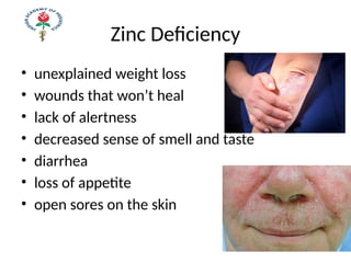 Zinc Deficiency
• unexplained weight loss
• wounds that won’t heal
• lack of alertness
• decreased sense of smell and taste
• diarrhea
• loss of appetite
• open sores on the skin
 