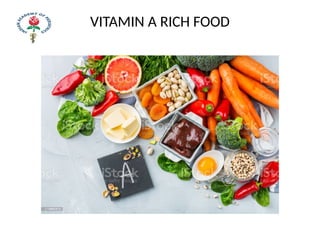 VITAMIN A RICH FOOD
 