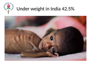 Under weight in India 42.5%
 