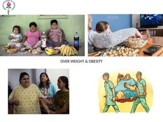 OVER WEIGHT & OBESITY
 