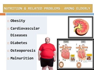 NUTRITION & RELATED PROBLEMS AMONG ELDERLY
 Obesity
 Cardiovascular
Diseases
 Diabetes
 Osteoporosis
 Malnurition
 