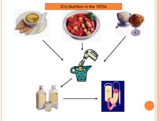 ICU Nutrition in the 1970s 
 
