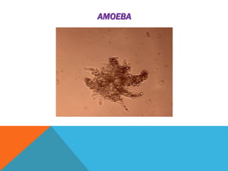 AMOEBA 
 