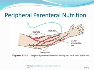 Peripheral Parenteral Nutrition
Mosby items and derived items © 2006 by Mosby,
Inc. Slide 57
 