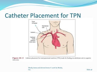 Catheter Placement for TPN
Mosby items and derived items © 2006 by Mosby,
Inc. Slide 58
 