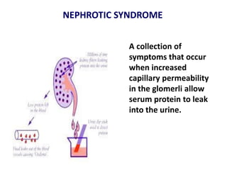 Nephrocity Nutrition in renal dosorders | PDF