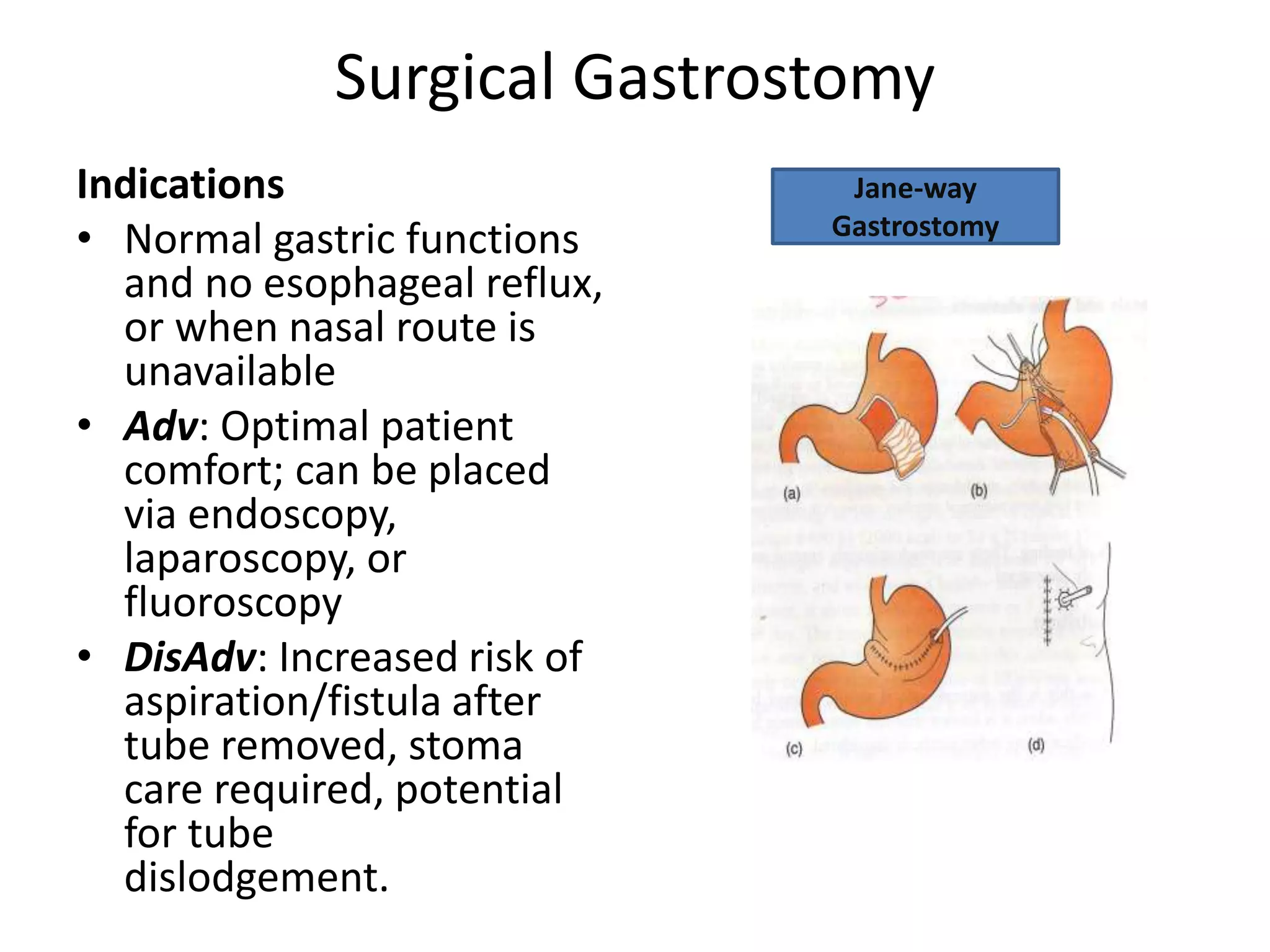 Nutrition in surgery | PPTX