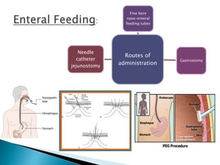 Routes of
administration
Fine bore
naso-enteral
feeding tubes
Gastrostomy
Needle
catheter
jejunostomy
 