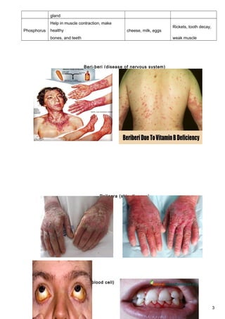 gland
Phosphorus
Help in muscle contraction, make
healthy cheese, milk, eggs
Rickets, tooth decay,
bones, and teeth weak muscle
Beri-beri (disease of nervous system)
Pellagra (skin disease)
Anaemia (shortage of red blood cell)
Scurvy (bleeding gums)
3
 