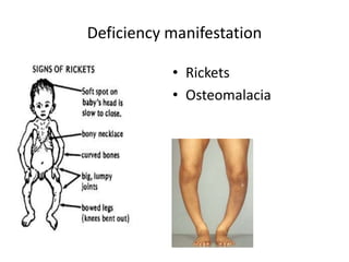 Rickets Graph Nutrition and oral health | PPTX