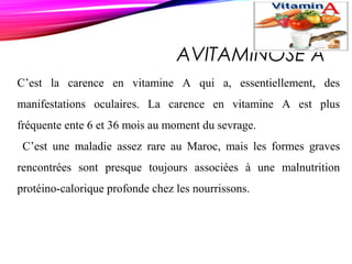 AVITAMINOSE A
C’est la carence en vitamine A qui a, essentiellement, des
manifestations oculaires. La carence en vitamine A est plus
fréquente ente 6 et 36 mois au moment du sevrage.
C’est une maladie assez rare au Maroc, mais les formes graves
rencontrées sont presque toujours associées à une malnutrition
protéino-calorique profonde chez les nourrissons.
 