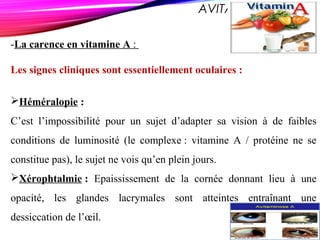 AVITAMINOSE A
-La carence en vitamine A :
Les signes cliniques sont essentiellement oculaires :
Héméralopie :
C’est l’impossibilité pour un sujet d’adapter sa vision à de faibles
conditions de luminosité (le complexe : vitamine A / protéine ne se
constitue pas), le sujet ne vois qu’en plein jours.
Xérophtalmie : Epaississement de la cornée donnant lieu à une
opacité, les glandes lacrymales sont atteintes entraînant une
dessiccation de l’œil.
 