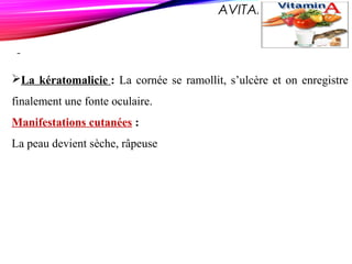 AVITAMINOSE A
La kératomalicie : La cornée se ramollit, s’ulcère et on enregistre
finalement une fonte oculaire.
Manifestations cutanées :
La peau devient sèche, râpeuse
 