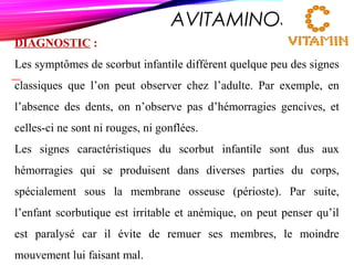 AVITAMINOSE C
DIAGNOSTIC :
Les symptômes de scorbut infantile différent quelque peu des signes
classiques que l’on peut observer chez l’adulte. Par exemple, en
l’absence des dents, on n’observe pas d’hémorragies gencives, et
celles-ci ne sont ni rouges, ni gonflées.
Les signes caractéristiques du scorbut infantile sont dus aux
hémorragies qui se produisent dans diverses parties du corps,
spécialement sous la membrane osseuse (périoste). Par suite,
l’enfant scorbutique est irritable et anémique, on peut penser qu’il
est paralysé car il évite de remuer ses membres, le moindre
mouvement lui faisant mal.
 
