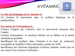 AVITAMINOSE K
Le rôle physiologique de la vitamine k :
La vitamine K intervienne dans la synthèse hépatique de la
prothrombine.
Les causes de l’avitaminose k :
Carence d’apport qui s’observe chez le nouveau-né rarement chez
l’adulte.
Carence d’absorption : la sécrétion biliaire est en défaut ou le transit
intestinal est perturbé.
Insuffisance de synthèse dans l’intestin à la suite de traitement
susceptible de modifier la flore intestinale, comme les ATB.
Insuffisance des fonctions hépatiques (cirrhose, hépatite virale) qui est
une cause d’une carence d’utilisation.
 