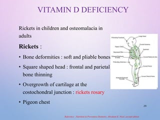 Nutrition and Orthodontics (Embarking on orthodontic treatment is a ...