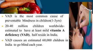 Cont…
 VAD is the most common cause of
preventable blindness in children(1-3yrs)
 20-40 million children worldwide-
estimated to have at least mild vitamin A
deficiency (VAD), half reside in India.
 VAD causes an estimated 60,000 children in
India to go blind each year.
 