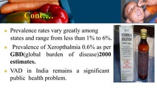 Cont….
 Prevalence rates vary greatly among
states and range from less than 1% to 6%.
 Prevalence of Xeropthalmia 0.6% as per
GBD(global burden of disease)2000
estimates.
 VAD in India remains a significant
public health problem.
 