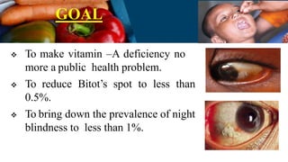 GOAL
 To make vitamin –A deficiency no
more a public health problem.
 To reduce Bitot’s spot to less than
0.5%.
 To bring down the prevalence of night
blindness to less than 1%.
 