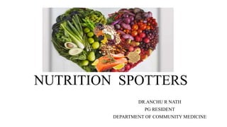 NUTRITION SPOTTERS
DR.ANCHU R NATH
PG RESIDENT
DEPARTMENT OF COMMUNITY MEDICINE
 