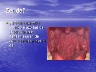 • Disfonia hitzarekin
loturiko arazo bat da,
ahotsa galtzen
denean ezaren da
afonia dagoela esaten
da.
Zer da?
 