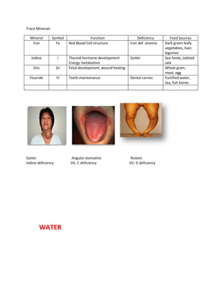 Nutrtion and diet therapy prelim