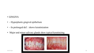 Prolong Def Nutrtion in Geriatrics | PPTX