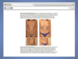 Nuts and Bolts of Content Marketing for Plastic Surgeons