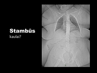 Stambūs
kaulai?
 