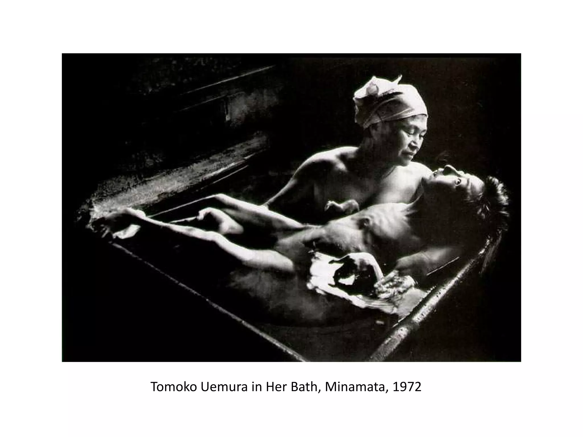 Tomoko Uemura in Her Bath, Minamata, 1972

 