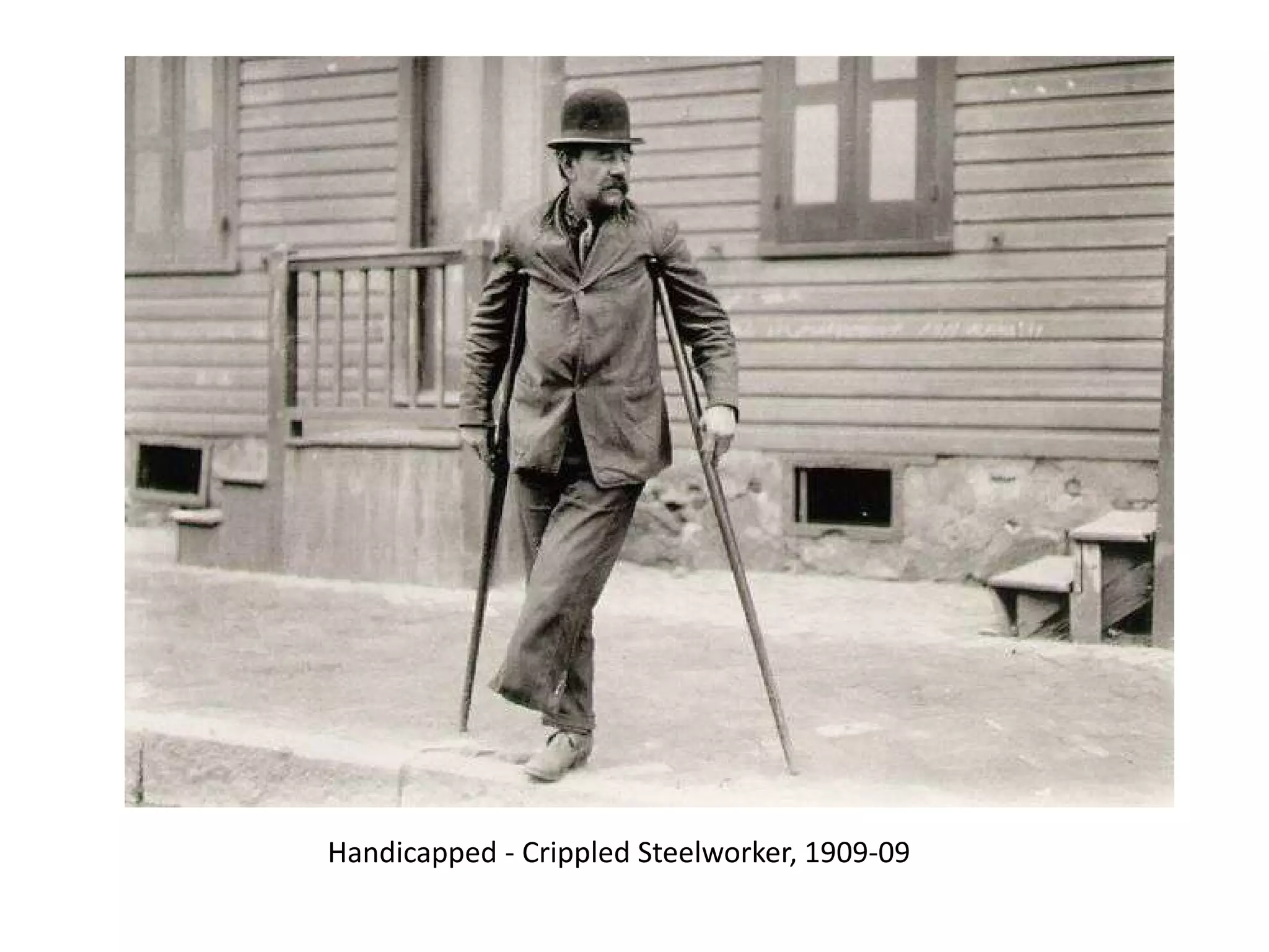 Handicapped - Crippled Steelworker, 1909-09

 