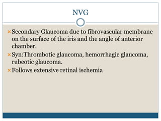 NVG
Secondary Glaucoma due to fibrovascular membrane
on the surface of the iris and the angle of anterior
chamber.
Syn:Thrombotic glaucoma, hemorrhagic glaucoma,
rubeotic glaucoma.
Follows extensive retinal ischemia
 